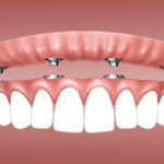 Dental Technician Questions and Answers