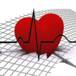 ECG Technician Questions and Answers