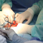 Medical Surgical Nursing Questions and Answers