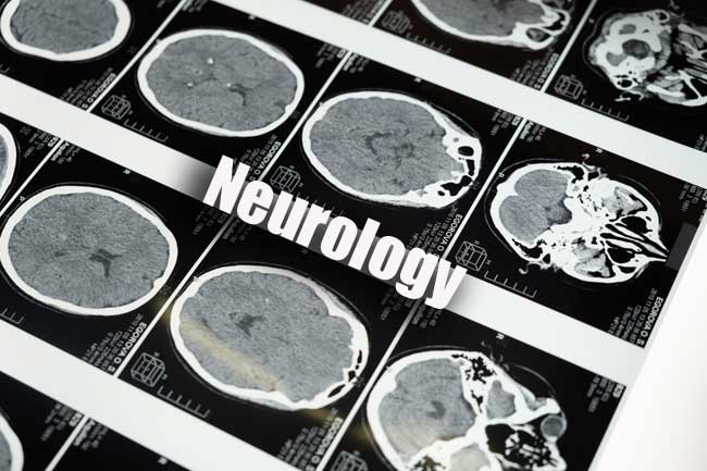 Neurology Quiz
