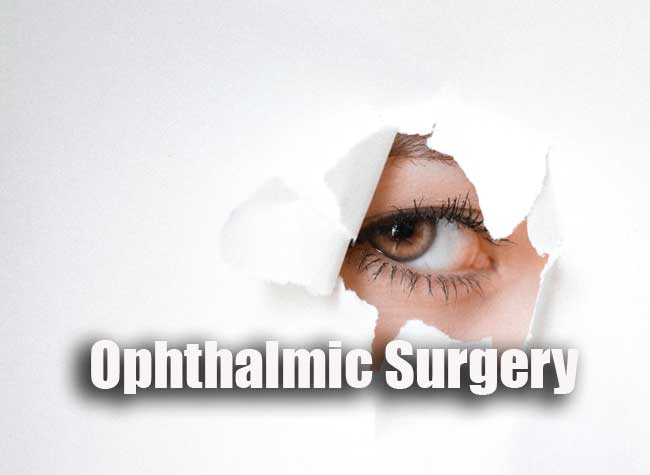 Ophthalmic Surgery Questions and Answers