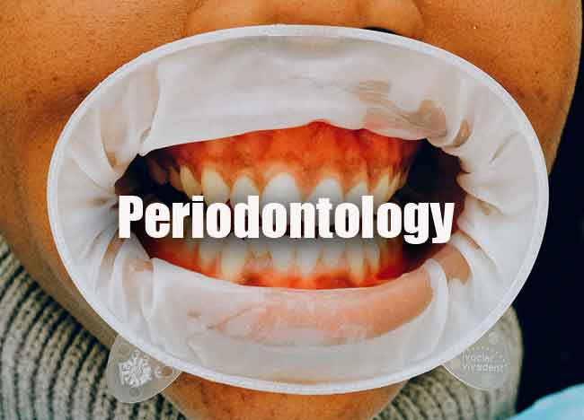 Periodontology MCQ