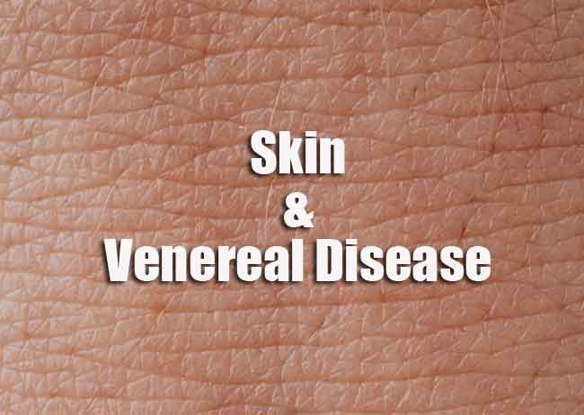 Skin and V D Quiz